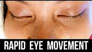 REM sleep - Rapid Eye Movement Sleep - REMS