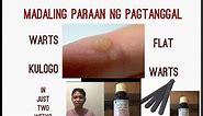 Paano matanggal ang kulugo? | DIY Warts Removal on easy steps