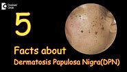 5 Facts about Dermatosis Papulosa Nigra | What are DPN’s - Dr. Divya Sharma|Doctors' Circle