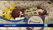 Miracle Premature Baby Goes Home On Due Date