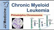 Chronic Myeloid Leukemia (CML) | Pathogenesis, Symptoms and Treatment
