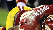 RG3 Injury Video: Dissecting Play That Further Damaged Robert Griffin III's Knee
