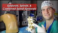 Epidural, spinal, and combined spinal-epidural overview