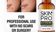 Review: SkinPro EXTREME Skin Tag Remover and Mole Corrector - DIY Health | Do It Yourself Health Guide by Dr Prem