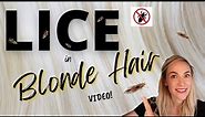 Lice in Blonde Hair