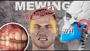 The Dangers of Mewing/Jawline Exercises
