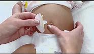 Baby Belly Button Shaper Instructions Video