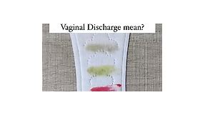 1️⃣ White: This typically indicates a normal discharge. It’s usually milky or creamy and can change during your menstrual cycle.If it’s like cottage cheese, accompanied by a strong smell and itching, it could be sign of an underlying yeast infection. 2️⃣ Green: A greenish hue could be a sign of an infection, such as trichomoniasis or certain types of bacteria. It’s important to see a healthcare provider if you notice this color. 3️⃣ Pink: Pink discharge might occur after intercourse or during sp
