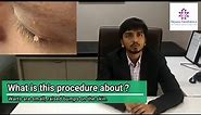 Wart Removal from eyelid live surgery and explanation by Plastic Surgeon in Ahmedabad,Gujarat