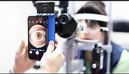 Slit Lamp iPhone Photography 3 essential steps
