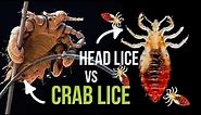 Crab Lice vs Head Lice - What is the Difference?
