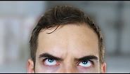 FIX MY FOREHEAD (YIAY #333)