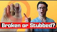 Stubbed Toe or Broken Toe? [Symptoms, Pain Relief & Treatment!]