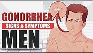 Signs and Symptoms of Gonorrhea in Men | sexually transmitted disease