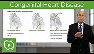 Congenital Heart Disease – Cardiology | Lecturio