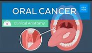 Oral cancer: Epidemiology, risk factors, prevention, symptoms and treatment | Kenhub
