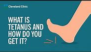 What Is Tetanus and How Do You Get It?