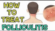 HOW TO TREAT FOLLICULITIS FAST