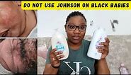 How I cleared my baby's Rash Eczema in 1 month | Do not use Johnson baby products on black babies