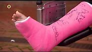 Clip 67 broken leg cast and wheelchair slc