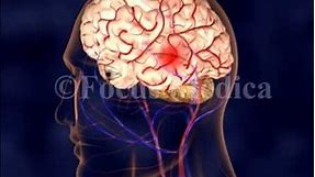 Cerebral angiography - Neuroanatomy