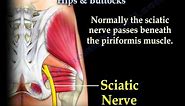 Muscle Anatomy Of The Hips & Buttocks - Everything You Need To Know - Dr. Nabil Ebraheim