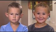 Parents Allow 6-Year-Old Boy with Big Ears to Get Plastic Surgery