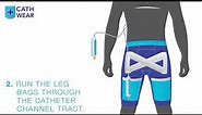 Nephrostomy Drainage Catheter