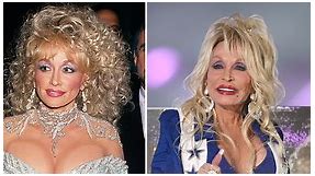 Dolly Parton's Most Revealing and Jaw-Dropping Outfits [Photos]