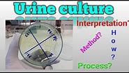 Urine culture test procedure Microbiology