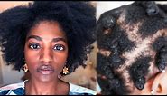 FINE. NATURAL. HAIR. | The Realities of Fine 4C Natural Hair