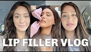 LIP FILLER VLOG | Before and after + the healing process!