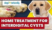 Home Treatment For Interdigital Cysts