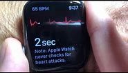 How to use Apple's ECG App on the Apple Watch and Phone