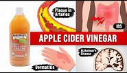 9 Unexpected Amazing Benefits of Apple Cider Vinegar (ACV)