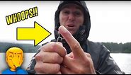Best Way To Remove A FISHING HOOK. Real Life Demonstration!
