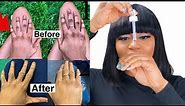 The Ultimate Way to Get Rid Of Dark Knuckles Faster + How to Maintain It