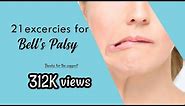 21 EXERCISES FOR BELL'S PALSY 🚫 DO NOT DO THESE DURING COMPLETE PALSY/INITIAL DAYS