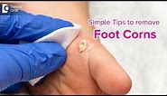 Simple tips to get rid of Foot Corn | Causes, Symptoms, Treatment-Dr. Rasya Dixit | Doctors' Circle