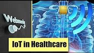 Top Uses of Internet of Things (IoT) in Healthcare | IoMT Examples