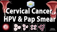 Cervical Cancer, HPV, and Pap Test, Animation
