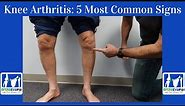 Knee Arthritis- 5 Most Common Signs You Have It!