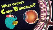 What Causes Color Blindness? | WhatIs COLOR BLINDNESS? | Dr Binocs Show | Peekaboo Kidz