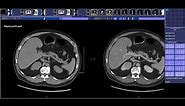 How to read a Renal Mass CT