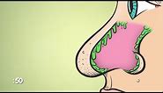What Are Boogers? | WebMD
