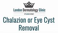 Eyelid Skin Tag Removal (Same Day) | London Dermatology Clinic
