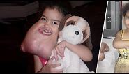The world's biggest Chin baby's turned 10 years old, and this is what She look like now!