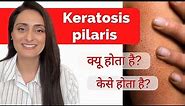 Keratosis Pilaris Treatment | Causes | Precautions | How to improve | Dermatologist recommends