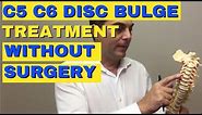 C5 C6 Disc Bulge Treatment Without Surgery | Bulging Disc C5 C6 | Dr. Walter Salubro