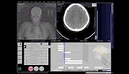 CT Cerebral Angio Full Work Process (SIEMENS) in syngo acquisition workplace
